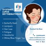 Systemic Lupus Erythematosus (SLE) Causes Symptoms and Treatments