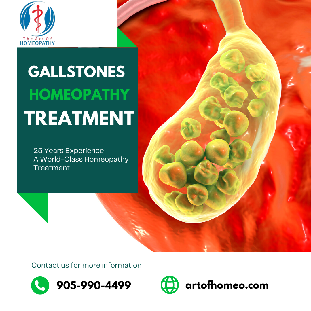 Gallstones Homeopathy Treatment