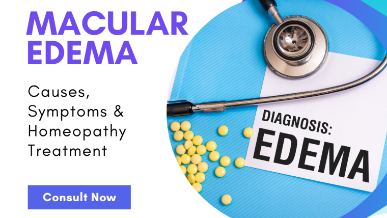 Macular Edema