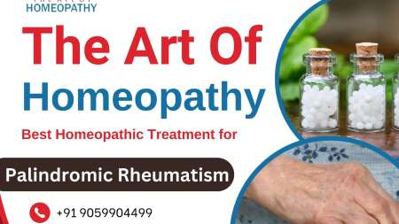 Palindromic Rheumatism