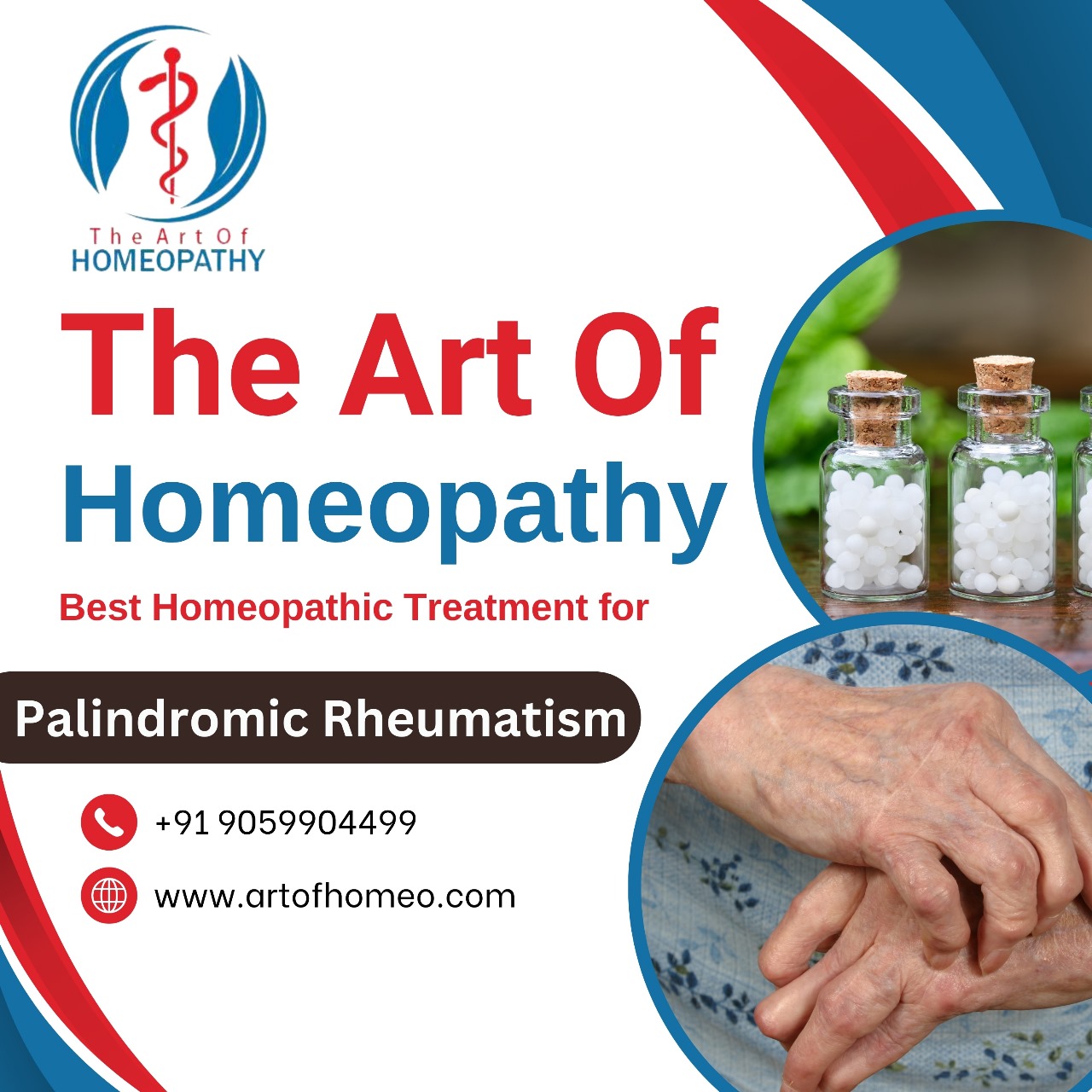 Palindromic Rheumatism