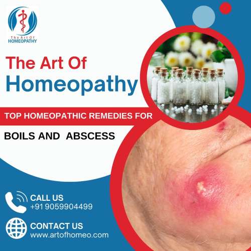 Boils And Abscess
