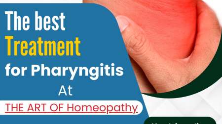 Best Treatment For Pharyngitis With Homeopathy Medicine