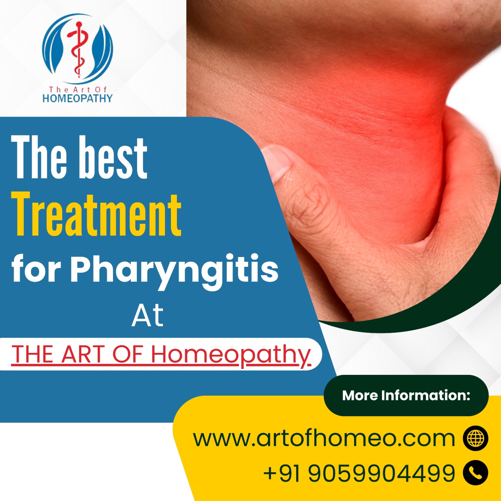 Best Treatment For Pharyngitis With Homeopathy Medicine